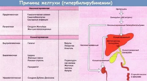 як лікувати жовтяницю у дорослих