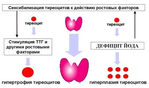 як лікувати хворобу зоб