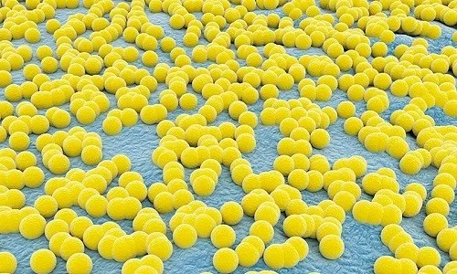 як лікувати золотистий стафілокок і фурункульоз