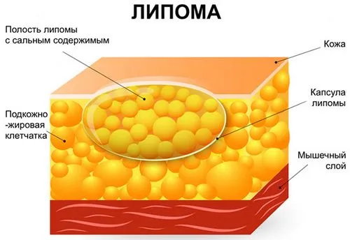 симптоми