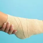 як лікувати бурсит п'яти