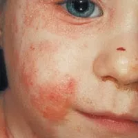 здоров'я дитини