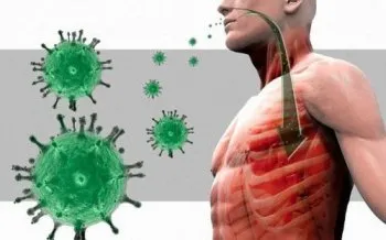 як лікувати атипову пневмонію