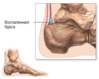 ззаду