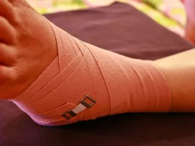 як лікувати розтягнення в домашніх умовах