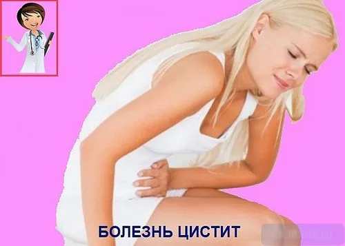 сечовий міхур