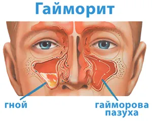 причини