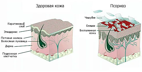 здоров'я