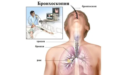 як лікувати розпад легенів