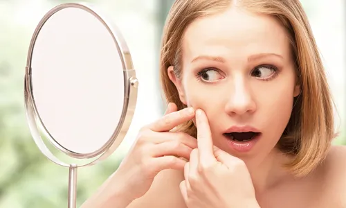 як лікувати прищі під час вагітності