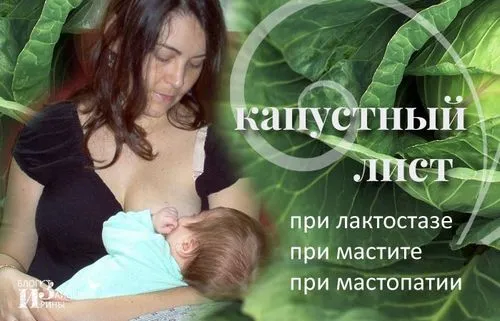 капустяний лист при лактостазе і мастопатії. як прикладати
