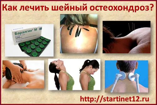 як лікувати остеохондроз