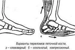 здорові стопи