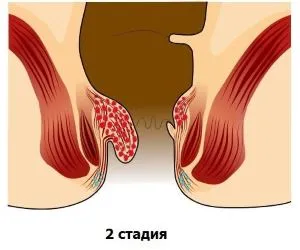 лікування