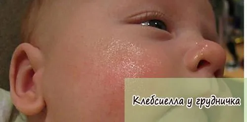 як вилікувати пневмонію у грудничка