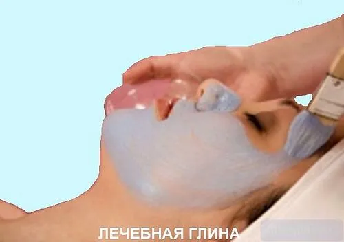 лікування глиною