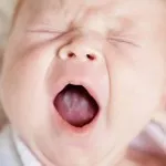 як лікувати молочницю мови