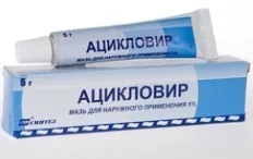 Лікування вітрянки у дітей лікування