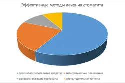 Лікування стоматиту дантист будинку