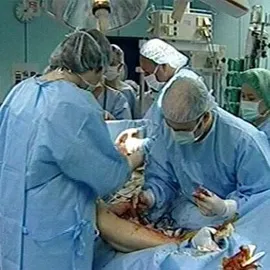 як лікувати лімфостаз руки народними засобами