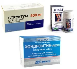 як лікувати остеохондроз медикаментозно