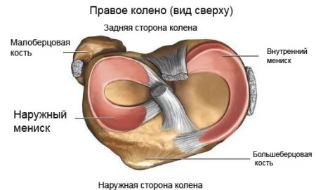 як лікувати меніск коліна