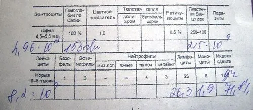 Чи можна вилікувати псоріаз сироїдінням чи можна вилікувати псоріаз сироїдінням