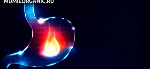 Муміє при гастриті муміє при гастриті