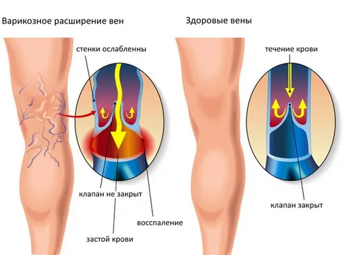 профілактика