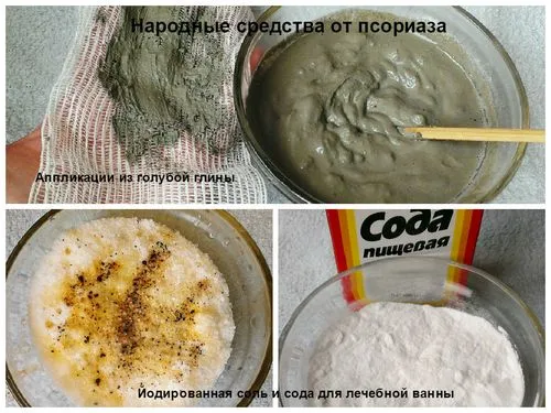 Лікуємо псоріаз в домашніх умовах як лікувати псоріаз в домашніх умовах