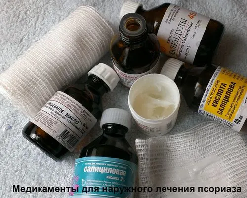 Лікуємо псоріаз в домашніх умовах як лікувати псоріаз шкіри