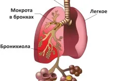 як лікують пневмонію у немовлят