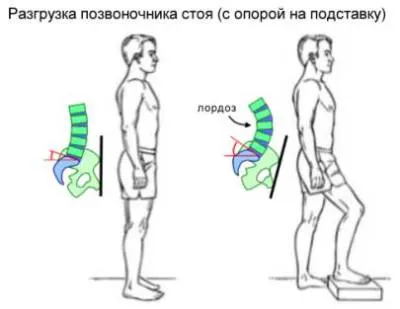 як лікувати лордоз шиї