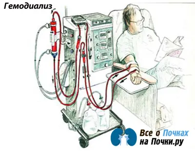 як лікувати нирки дієта
