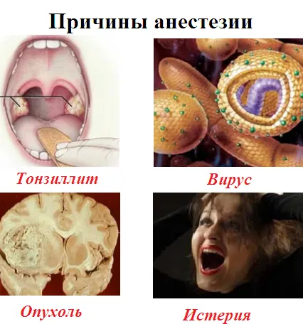 як лікувати невроз гортані