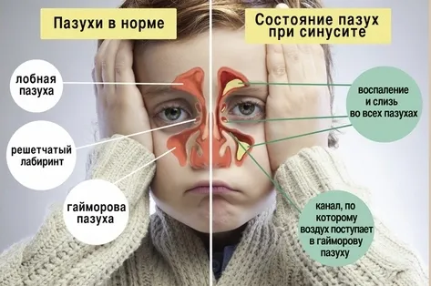 хронічний