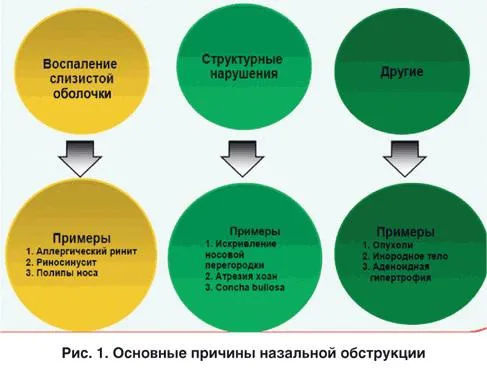 як лікувати нежить годувальниці