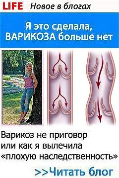 Список ефективних мазей від варикозу, варикозного розширення вен як лікувати варикоз мазями