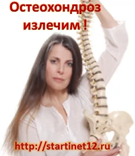 як лікувати ранній остеохондроз