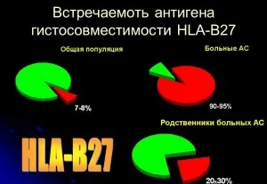 як лікувати ревматизм попереку