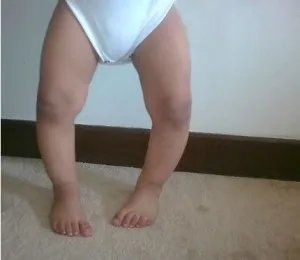 дитячі захворювання