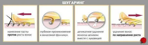 Роздратування в зоні бікіні стояти
