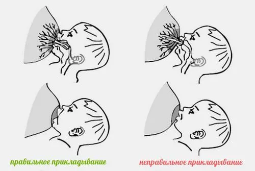як лікувати мастит після операції