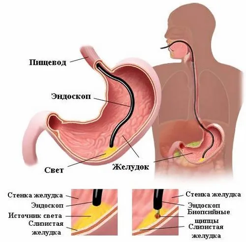 лікування