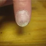 плече