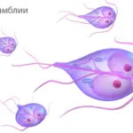 як лікувати глисти лямблії