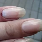 біль