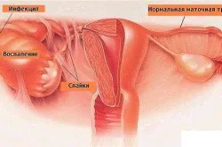 стоп ЗПСШ