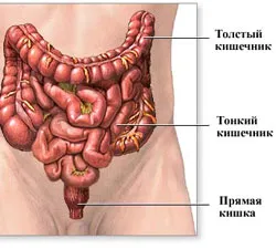 як лікувати запалений кишечник
