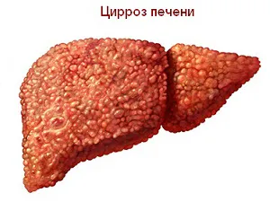 як лікувати печінку без таблеток
